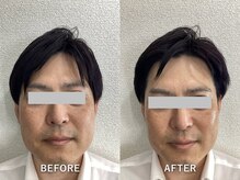 男性のお肌や頭皮のお悩みにもおすすめ！！