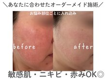 サロンラジュローズ(Salon La joue Rose)