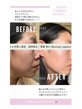 ミミルーチェ(mimiluce)/スッキリとしたフェイスライン