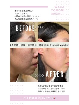 ミミルーチェ(mimiluce)/スッキリとしたフェイスライン