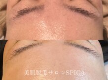 スピカ(SPICA)/艶々なおでこ
