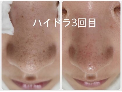 ウェルビーイング(well-being)の写真