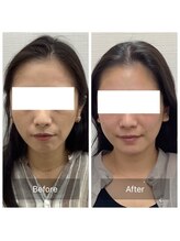 ハリナチュレ 那覇店(HARINATURE)/Before/After