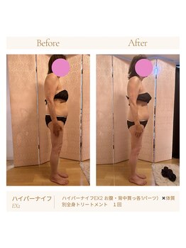 パチュプチ(Patchou petit)/Before→after/痩身