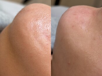 エネ ラッシュアンドブロウ バイ アンドエラ(ENNE Lash&Blow by&ERA)/グロスwax