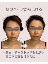 アンジェリカ(Angelica)/リフトアップはパーツごと上げる