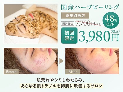 エピシア(EPICIA)の写真