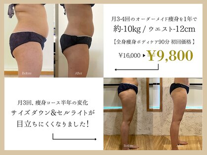 エステティックサロン エスぺランス(ESPERANCE)の写真