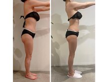 エイジングケアサロン 青山 本店/3種マシン・90分最強痩身！