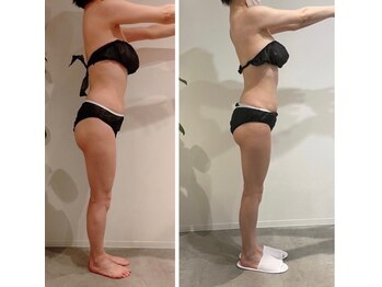 エイジングケアサロン 青山 本店/3種マシン・90分最強痩身!