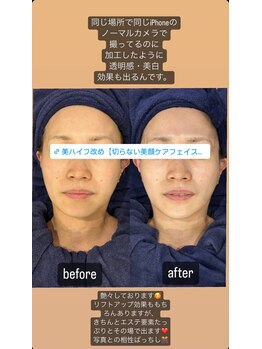 ラ ボーテ ド シル(La beaute de cil)/切らないリフトbefore→after