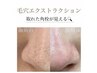 【2回目以降毛穴エクストラクション】
