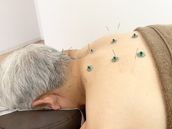 ウル鍼灸整骨院/鍼灸マッサージ