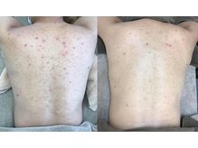 スリリアン 銀座/★お客さまビフォーアフター★