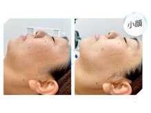 プライムデュオ(Prime Duo)/毛穴クリア＆温感リフト