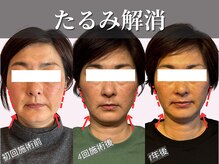 フレキシボディ(FlexiBody)の雰囲気（小顔矯正整体の回数を重ねる事で、より確実な小顔へ導きます！）