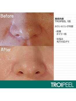 エミレーブ シロカネ(Hemireve Shirokane)/お悩みお聞かせください