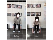 エモアメディカル整体院 麻布十番(Emoaメディカル整体院)/【70代女性】両膝痛