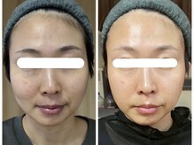 アップライン(Up Line)の雰囲気（最新エクソソームでお肌の深層から修復。老化に悩まない未来へ。）