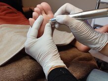 ドクターネイル爪革命ふわら