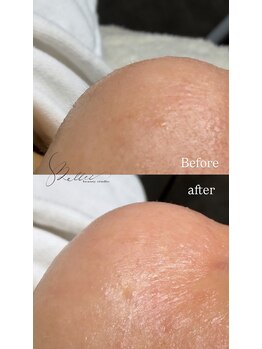 ベルティ(Bellti)/フェイシャルワックス