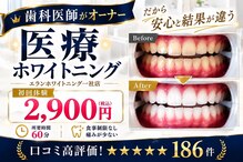 エランホワイトニング 一社店