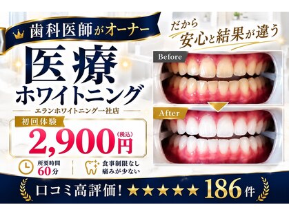 エランホワイトニング 一社店の写真