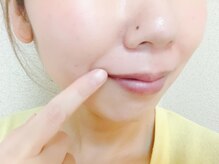 ベルヴィー(Belle vie)/鼻毛ワックス大人気！