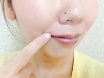 ベルヴィー(Belle vie)/鼻毛ワックス大人気!