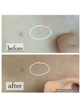 パル(PAL)/ビフォーアフター