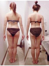 グレイスボディ BiViつくば店(Grace Body)/◆痩身　症例写真