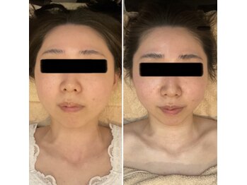 ラクシュミー/ビフォーアフター