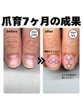 シェリエット(Cheriette)/美爪に導くジェルネイル(クリア)