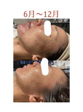 インチャント(enchant)/約半年間の結果