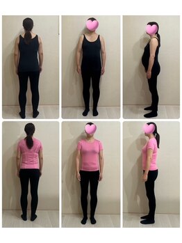 マナ(mana)/ポッコリお腹がスッキリ！