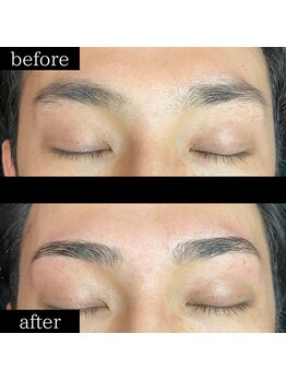 ユー 千葉駅前店(you)/症例写真