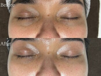 ルミナ シブヤ(LUMINA SHIBUYA)/【ダクトピール】1回目　目元