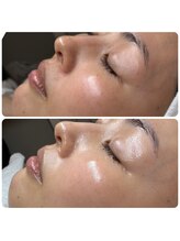 エミレーブ シロカネ(Hemireve Shirokane)/今の肌に必要なケアを見極めます