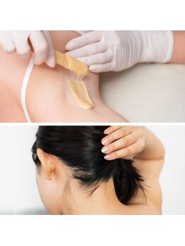 アルモ(ALMO)の写真/〈1箇所から選べるワックス脱毛で時短ケア〉残った産毛もワックスで一掃!パーツ脱毛で隙のないツルふわ肌へ