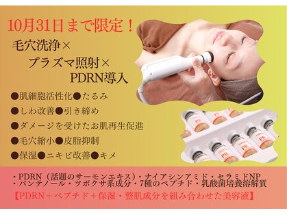 ビービー(BB)の写真