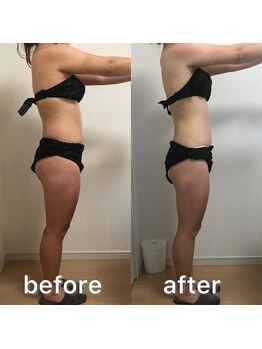 ベルフィーヌ 北千住店(BELFINE)/充実コースビフォーアフター