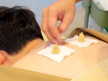 整骨院リライフ 熊本市北区本店(整骨院Re.life)/艾から行う本格お灸