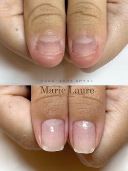 マリーロール 淀屋橋本店(Marie Laure)/自爪育成/深爪矯正/ネイルケア
