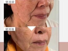 ザ アールアール(THE RR)/ゾンビパックの威力！