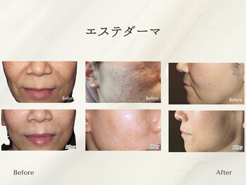 ホリスティックサロン ヘルバ(Holistic salon Herba)/エステダーマ