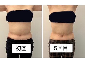 ナチュラル ユース(Natural youth)/リラクゼーション目的で痩せた！