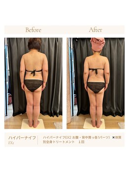 パチュプチ(Patchou petit)/Before→after/痩身