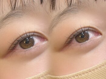 アム(Am)の写真/丁寧なカウンセリング×高技術で“なりたい”を叶えるプライベートサロン◇今だけ限定価格でご予約受付中!