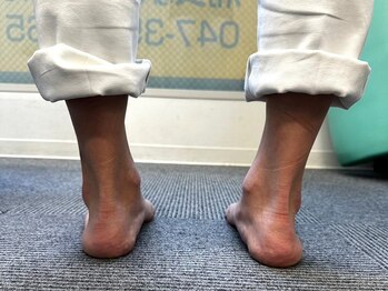 浦安駅前鍼灸整体院の写真/整体技術の中でも特に難しい≪O脚/X脚矯正≫カイロプラクティック★結果にこだわる高技術！【浦安駅前】