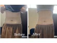 北上美腸サロン/浮腫み・冷え腸（内蔵型冷え性）